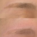 루에브로우 | 판교역 분당눈썹문신제거 전문 '루에브로우' 추천