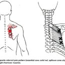 3. 등 견갑골 안측- 고황혈 부위의 통증 이미지