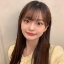 서울압구정아몬드성형외과 눈밑지방재배치수술후기 2~5개월차 (+비용,가격)