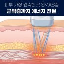 행복한제이피부과의원 | 노원역 피부과전문의 초음파 vs 고주파 리프팅 차이