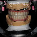 스마일 라인 치과기공소 이미지