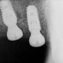 서울덴토피아치과의원 이미지