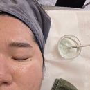 비전동 소로 3-99 | 비전동 피부관리 하나뷰티 평택점에서 물광톡스 받고 온 솔직 후기