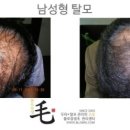 불로장생모