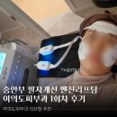 엔파로 | 여의도피부과 엔진리프팅 1회차 변화 : 통증 없는 페이스피트니스 동안리프팅 솔직 후기