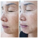 바나다뷰티(VANADA BEAUTY) | 군산 바나다뷰티에서 마사지받고 바나다~^^