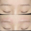 리르뷰티 | 당진 뷰티 시술 / 눈썹 잔흔 제거 솔직 후기! / 리르뷰티 방문했어요✨<리르뷰티>