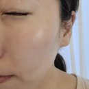 수성구 피부관리 디안스킨 에스테틱 플라이저 관리 후기