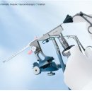 Aesculap PE204A neuroendoscope 이미지