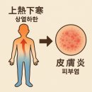 송파피부관리, 피부염의 뿌리를 다스리는 깊은 손끝