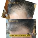 엑소나인 탈모 두피 셀프 케어 엑소좀 앰플 샴푸 사용후기