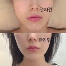 리숨 | 광주피부관리 광주신부관리 끝판왕✨ 건성·윤곽 고민 한번에 해결된 리숨에스테틱 시그니처 테라피 후기