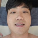 대우메디칼 | 천안 두정동 피부관리 비엘뷰티에서 스킨스케일링 후기