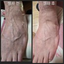 우리동네힐링샵 | 집에서 시작하는 똑똑한 케어 라라소닉과 라라셀파, 내 몸에 맞는 케어를 선택하세요