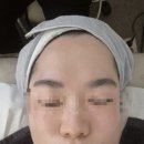 홍산초등학교 | 전주 효자동 맞춤형피부관리 『지음에스테틱』 모공, 홍조피부 RF리프팅 후기