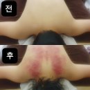경락마사지&바른체형지도사 | 빛의전신 경락&amp;SPA 대구전신경락 현풍마사지
