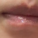 롬앤준컴퍼니 | 구순염 이후 롬앤이 보내준 시제품 후기 진심이 느껴지는 대응