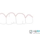 서울하이치과 네이버블로그