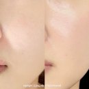 예쁨토탈뷰티샾 | 검단사거리 피부관리 : 예쁨토탈뷰티샵 웨딩케어 및 라인관리 후기