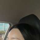 상무대로1-4 | 광주 상무지구 이마필러 4cc 내돈내산 한달차 후기(공장형x)