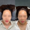 니즈헤어라인