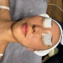 튠페라 튠페이스 튠라이너 이중턱 턱선리프팅 후기