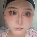 코가 | 저의 첫서코가 다시 돌아왓어요 5서코 후기