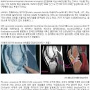 fMRI(function magnetic resonance imaging)원리, 뇌촬영,자기공명영상 이미지