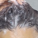 지성 | 지성두피샴푸 추천 내돈내산 후기 효과