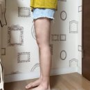 상상링크 | 상상하는 만큼 빠진다는 대구 동성로 다이어트 | 지방...6회차 | 허벅지 mpl 주사 리얼 후기 | 내돈내산 |