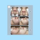 라뮤에스테틱 | [광주/쌍촌동] 라뮤에스테틱 : 턱 트러블·염증성 여드름 3회차 만에 극복! (찐내돈내산 솔직후기)