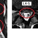 가을빛남자 님의 요추디스크, 흉추디스크 MRI 사진 판독입니다. 이미지