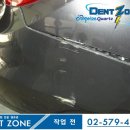 덴트존 네이버블로그