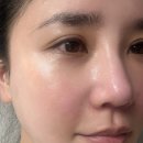 수진가새란약국 | 리쥬비란 PDRN 5000 리커버리 크림, 피부과 시술 후 필수인 재생크림 추천