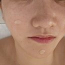 결혼 앞두고 웨딩관리 받고온 엘루엔에스테틱 천안점 방문후기