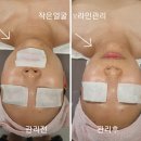 전주효자초등학교 | 전주삼천동피부관리 잘하는 수에스테틱 윤곽관리 전후 사진 보세요.