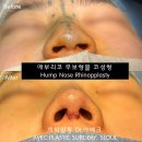 닥터본성형외과의원 이미지