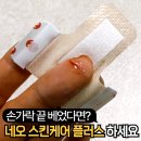 스킨플러스 - 서대문구 통일로 428-1 | 손 끝 반창고 손가락 끝 베였을 때 추천해요 - 네오 스킨케어 플러스 내돈내산 솔직후기