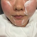네오 | 원주 피부과 네오페이스 후기 이중턱삭제 안티에이징리프팅 덴서티 후 관리추천 내돈내산