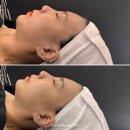 세븐일레븐 광주화정2호점 | 광주 최초 닥터밸루 합법레이저 엑스터 입점 : 광주 기미관리 설브 화정점