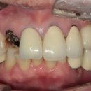 블루치과기공소 이미지