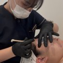 토탈아쿠아솔루션 | 인계동아쿠아필 피부손상없는 필링