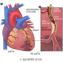 이럴 땐 심장 질환을 의심해 보세요 이미지