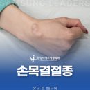 구리의손정형외과의원 | 구리역정형외과 손목에 물 찼을때, 반복되면 꼭 확인해야 할 손목결절종