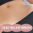 씨유 속초서희스타점 | 속초체형관리 에소코핏 속초점 프리미엄 다이어트 후기 (속초EMS 웨딩관리)