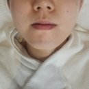 영등포 에스테틱 추천 구로 예신관리ㅣ 얼굴라인 정리 바이온다 리프팅 3회차 솔직 후기 ㅣ살롱드세이렌