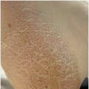 아우룸네일 이미지