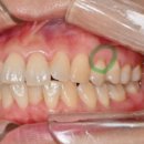 수원탑플란트치과의원 이미지