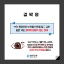 흔하지만 방치하면 위험할 수 있는 &#39;결막염&#39;⚡ 이미지
