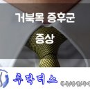 거북목증후군 증상 확인하고 치료받으러 오세요 이미지